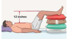 Millions of Americans have Edema - What is it and can it be cured?